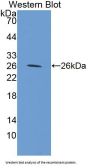 Sorting Nexin 17 (SNX17) Antibody