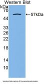 Nuclear Factor I/B (NFIB) Antibody
