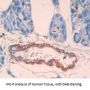 Carnitine Palmitoyltransferase 1B, Muscle (CPT1B) Antibody
