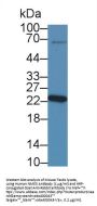Non Metastatic Cells 5, Protein NM23A Expressed In (NME5) Antibody
