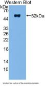 Non Metastatic Cells 5, Protein NM23A Expressed In (NME5) Antibody
