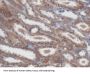 Non Metastatic Cells 5, Protein NM23A Expressed In (NME5) Antibody