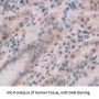 Ribosomal Protein S6 Kinase Beta 1 (RPS6Kb1) Antibody