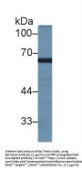 Myxovirus Resistance 2 Antibody