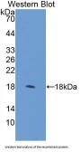 RCC1 And BTB Domain Containing Protein 2 (RCBTB2) Antibody