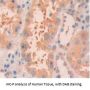 RCC1 And BTB Domain Containing Protein 2 (RCBTB2) Antibody