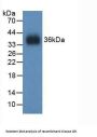 Glutathione Reductase Antibody