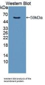 Aryl Hydrocarbon Receptor (AhR) Antibody