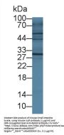 Interleukin 4 Receptor (IL4R) Antibody