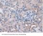Glutathione Peroxidase 3, Plasma Antibody