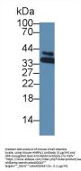 Heterogeneous Nuclear Ribonucleoprotein A1 (HNRPA1) Antibody