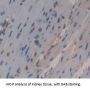 Heterogeneous Nuclear Ribonucleoprotein A1 (HNRPA1) Antibody