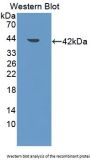 Low Density Lipoprotein Receptor Adaptor Protein 1 Antibody