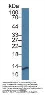 Prolylcarboxypeptidase (PRCP) Antibody