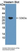 Tenascin X (TNX) Antibody