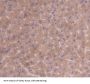 Pyruvate Dehydrogenase Kinase Isozyme 3 (PDK3) Antibody