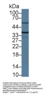 Transmembrane Protease, Serine 2 (TMPRSS2) Antibody
