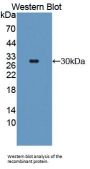 Transmembrane Protease, Serine 2 (TMPRSS2) Antibody