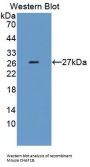 Chromatin Assembly Factor 1, Subunit B (CHAF1B) Antibody