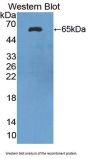 Oxoguanine Glycosylase 1 (OGG1) Antibody