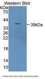 Phosphodiesterase 12 (PDE12) Antibody