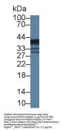 Epoxide Hydrolase 4 (EPHX4) Antibody