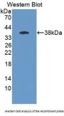 Epoxide Hydrolase 4 (EPHX4) Antibody