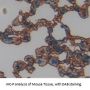 Epoxide Hydrolase 4 (EPHX4) Antibody