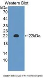 Chromogranin A Antibody