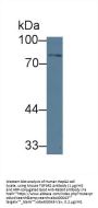 Transforming Growth Factor Beta Receptor II (TGFbR2) Antibody