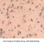 Crystallin Gamma F (CRYgF) Antibody