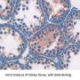 Angiotensin I Converting Enzyme (ACE) Antibody