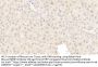 Inhibin beta E Antibody