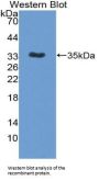 Interleukin 12B (IL12B) Antibody