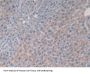 Interleukin 2 (IL2) Antibody