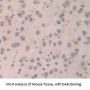 Galectin 7 (LGALS7) Antibody