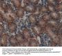 Microtubule Associated Protein 1A (MAP1A) Antibody