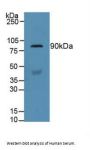 Gelsolin (GSN) Antibody