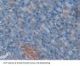 Gelsolin (GSN) Antibody