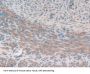 Gelsolin (GSN) Antibody