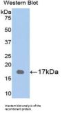 Retinol-Binding Protein 1 (RBP1) Antibody