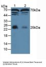 Myelin Basic Protein (MBP) Antibody
