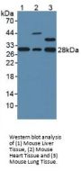 Glutathione S Transferase Omega 1 (GSTo1) Antibody