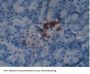 Glutathione S Transferase Omega 1 (GSTo1) Antibody