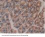 Glutathione S Transferase Omega 1 (GSTo1) Antibody