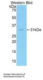 Coagulation Factor V Antibody