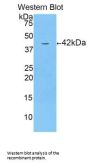Corticotropin Releasing Hormone (CRH) Antibody
