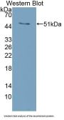 Receptor Activator Of Nuclear Factor kappa B Ligand Antibody