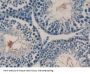 Receptor Activator Of Nuclear Factor kappa B Ligand Antibody