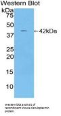 Ceruloplasmin (CP) Antibody